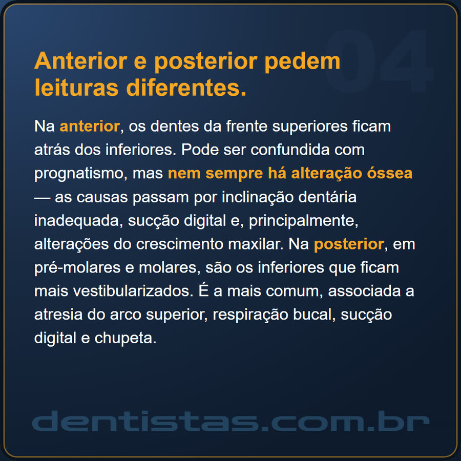 Slide 4 de 6 da edição
