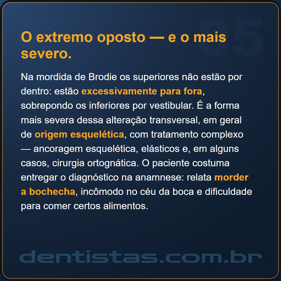 Slide 5 de 6 da edição
