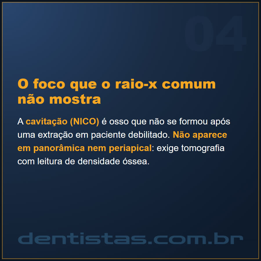 Slide 4 de 6 da edição