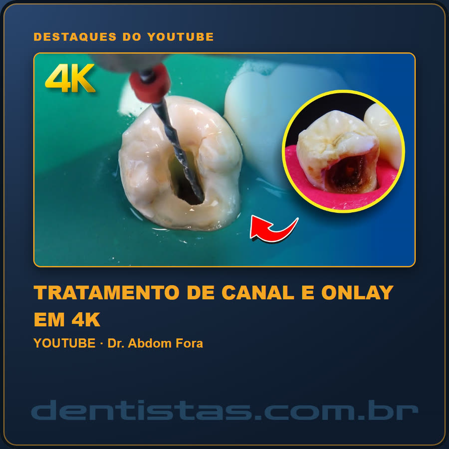 Slide 2 de 6 da edição
